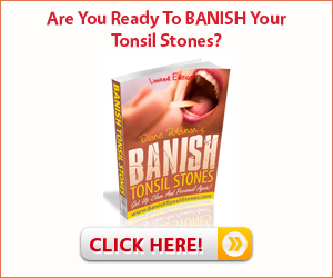 Banish Tonsil Stones